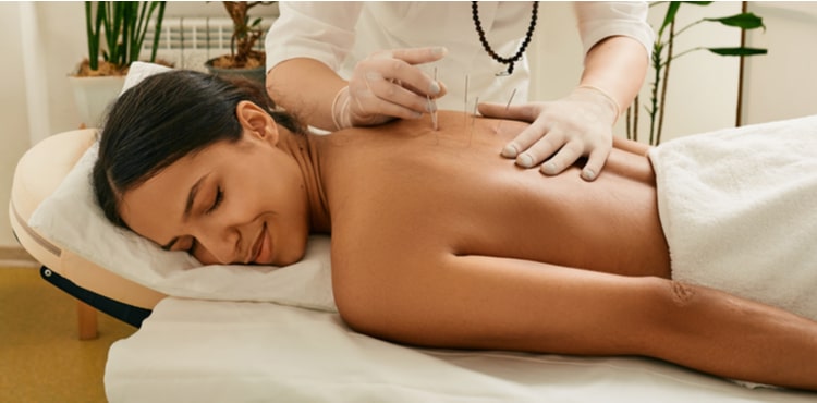 Person receiving acupuncture treatment. Person receiving acupuncture treatment.
