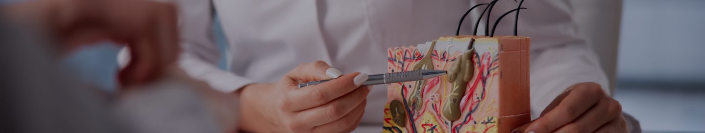 A dermatologist uses a model of the skin to explain a condition to a patient.