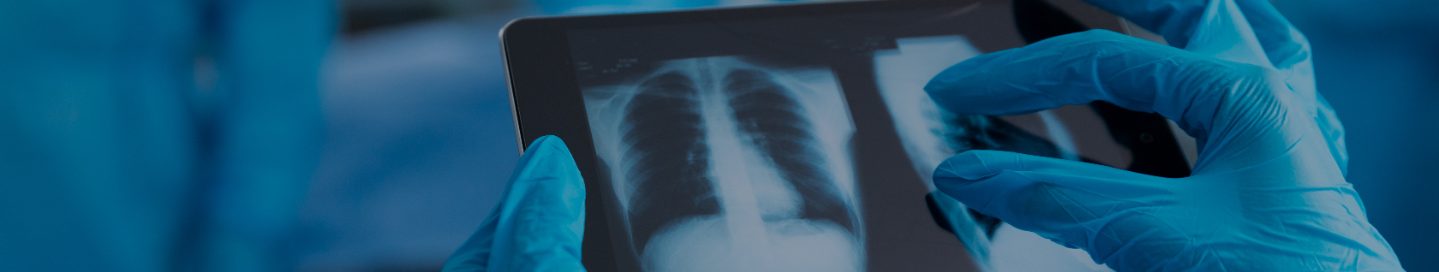 A respiratory therapist reviews a patient's chest X-ray.